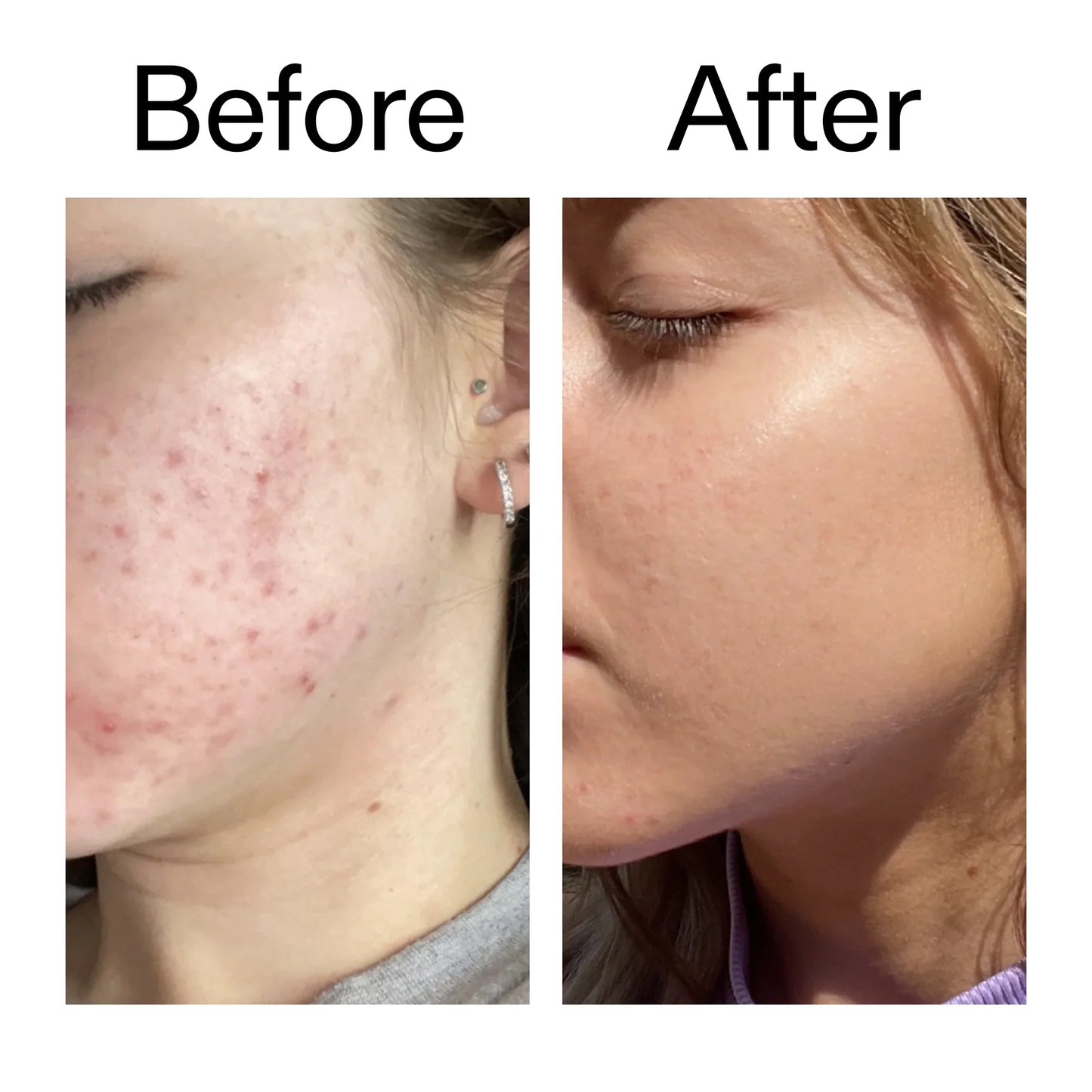 The Inkey List 10% Niacinamide Serum - 30ml