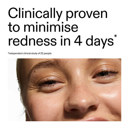 The Inkey List 10% Azelaic Acid Serum for Redness Relief - 30ml