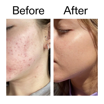 The Inkey List 10% Niacinamide Serum - 30ml
