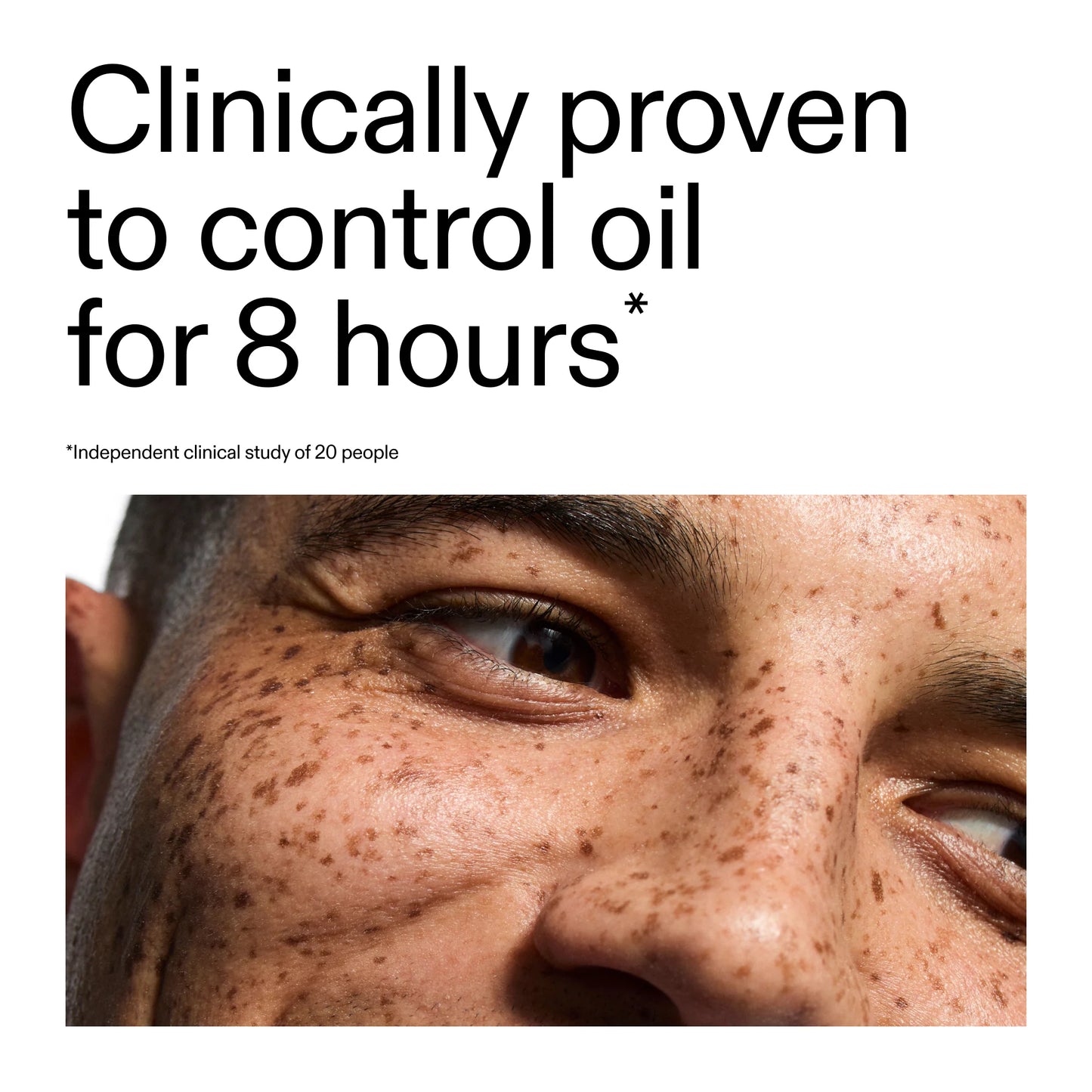 The Inkey List 20% Niacinamide Serum - 30ml