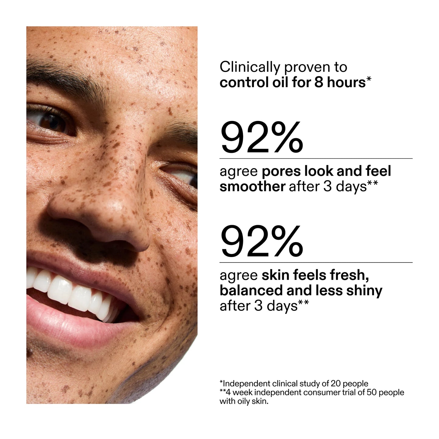 The Inkey List 20% Niacinamide Serum - 30ml