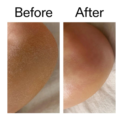 The Inkey List Glycolic Acid Exfoliating Body Stick - 45g