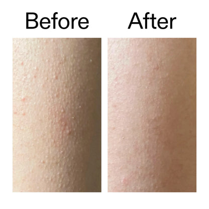 The Inkey List Glycolic Acid Exfoliating Body Stick - 45g