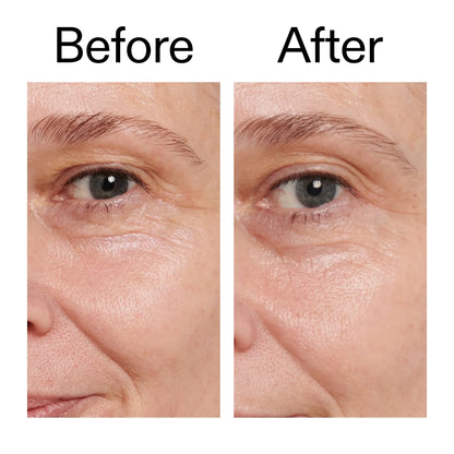 The Inkey List Retinol Eye Cream - 15ml