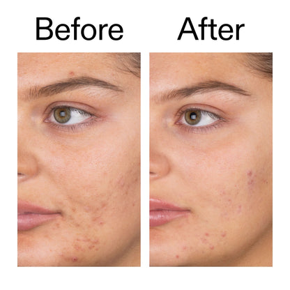 The Inkey List Salicylic Acid Cleanser - 150ml