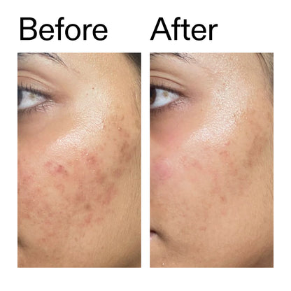 The Inkey List Ectoin Hydro-Barrier Serum - 30ml