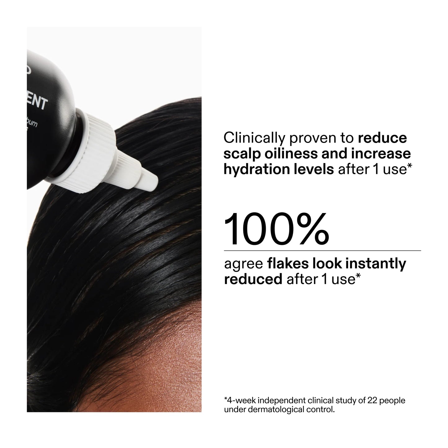 The Inkey List Salicylic Acid Exfoliating Scalp Treatment - 150ml