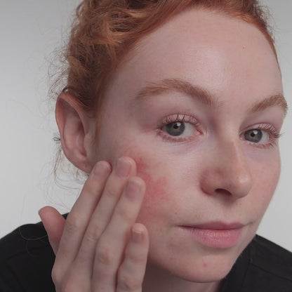 The Inkey List 10% Azelaic Acid Serum for Redness Relief - 30ml